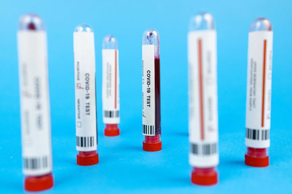COVID-19 blood test tubes with labels on blue background.
