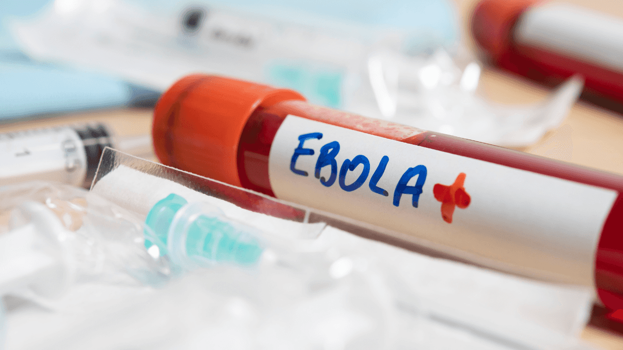 Tubo de ensayo con muestra de sangre identificado como ébola sobre material médico de laboratorio.
